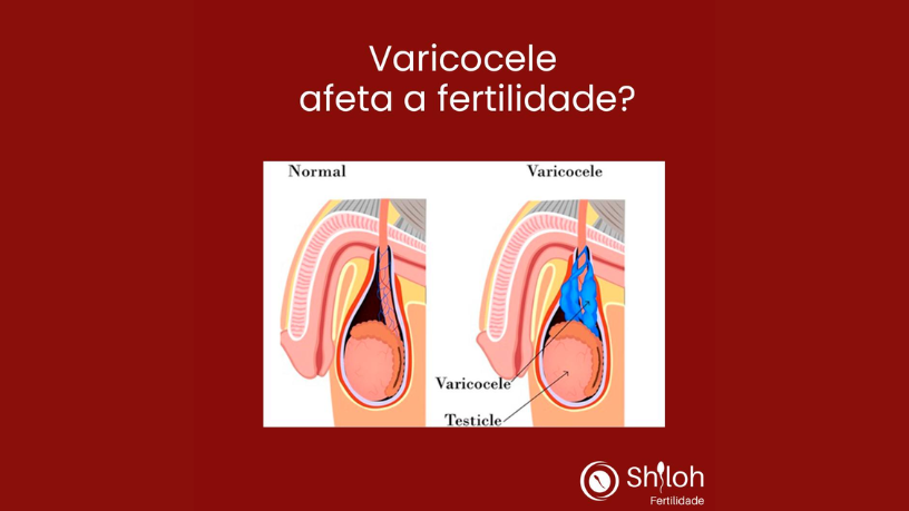O impacto silencioso do tabagismo passivo na infertilidade é analisado por Oluwatosin Tolulope Ajidahun.